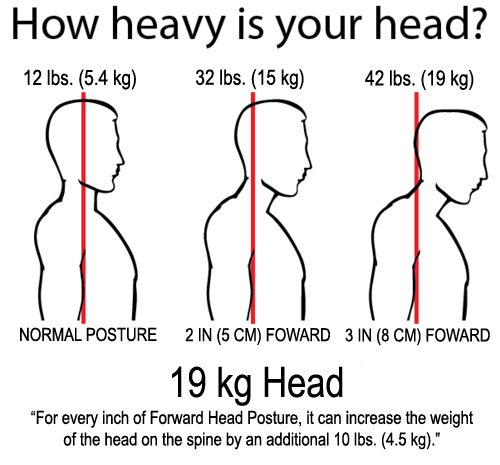 Image result for forward head posture